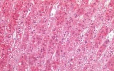 Immunohistochemistry-Paraffin: TIAM1 Antibody [NBP3-14496]